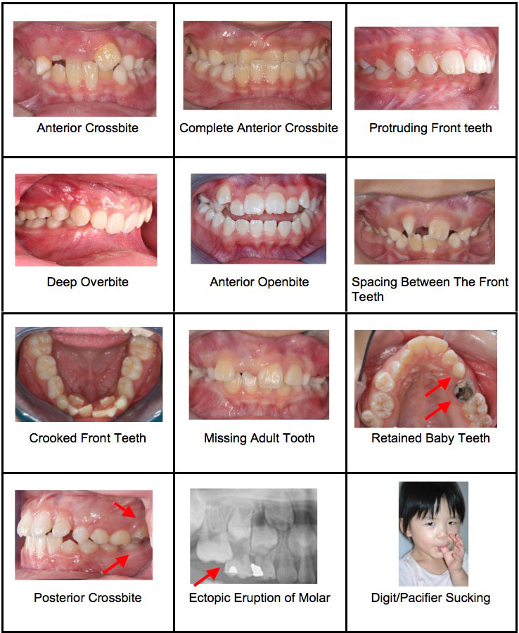 Your Childs Teeth: A Complete Guide for Parents